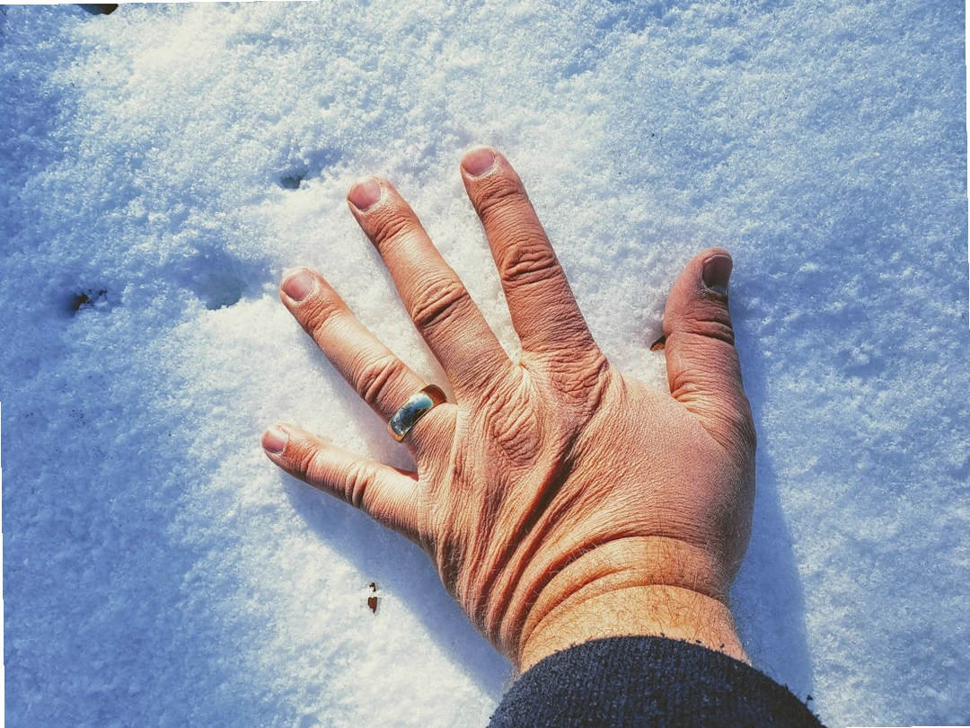 손발냉증 원인과 관련된 이미지